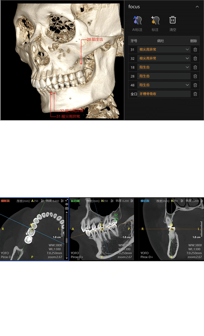 口腔CT智能报告