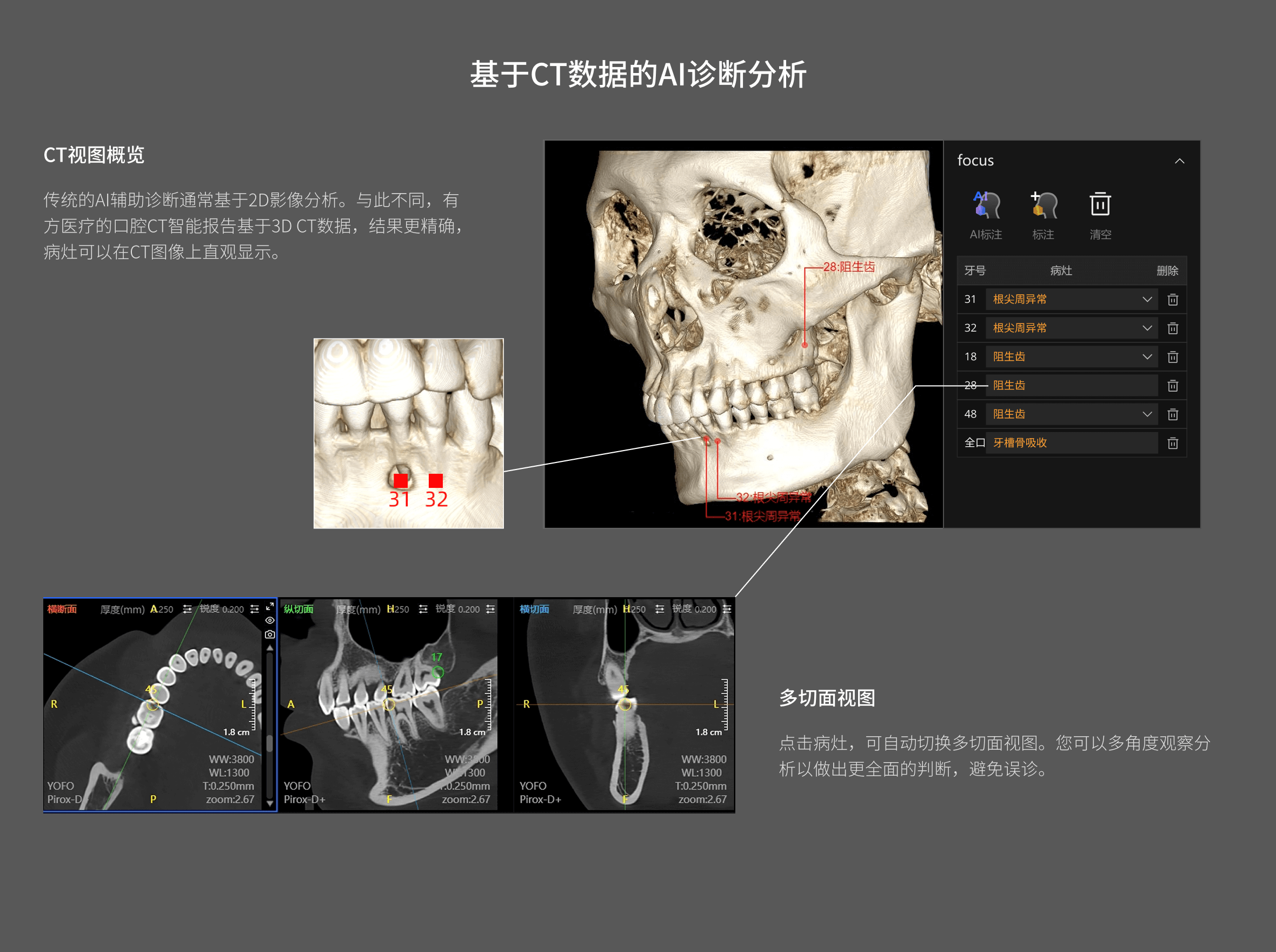 口腔CT智能报告