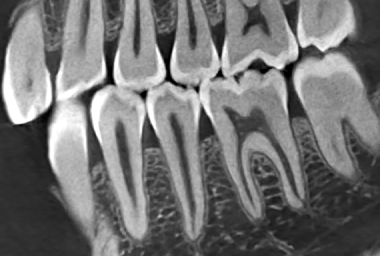 40lp/cm超高清成像