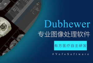 有方派CT影像中心——Dubhewer全新功能先睹为快！